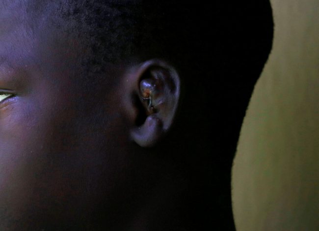 Vết tích bị hành hạ ghi dấu trên tai của một học sinh vị thành niên. "Hệ thống trường Almajiri là vỏ bọc cho những kẻ tội phạm, lạm dụng trẻ em Nigeria, những trẻ vị thành niên và đẩy chúng vào những hành xử phi xã hội, và cuối cùng là sử dụng chúng như những nô lệ tình dục", báo Guardian viết