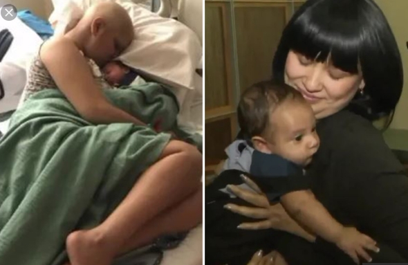 Jade trước và sau khi điều trị thành công căn bệnh ung thư vú. (Ảnh: The Sun)