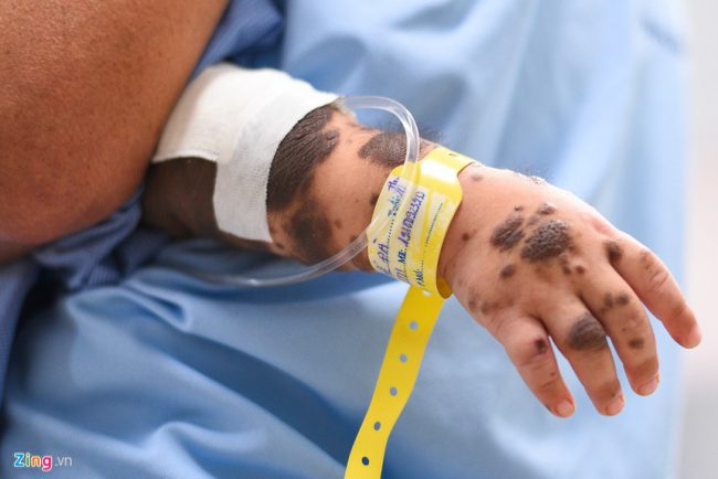 Giây phút đầu tiên anh Thắng bế Đà ra khỏi phòng phẫu thuật