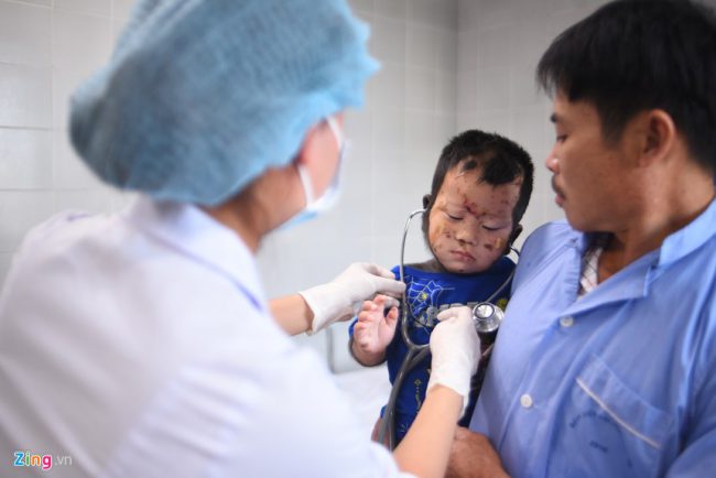 Cô điều dưỡng Hồng Nguyệt là người theo dõi tình hình hậu phẫu hàng ngày của Đà