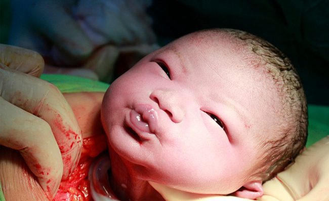 be-gai-mat-co-hoi-chao-doi