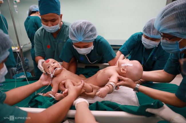 mo-tach-ca-song-sinh-hiem-gap