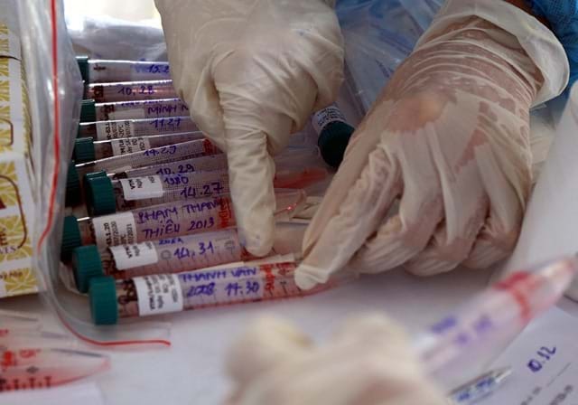 vaccine-va-nhung-van-de-con-bo-ngo