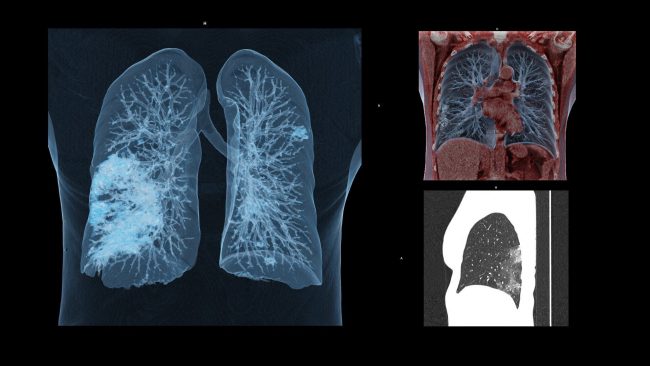 su-bat-binh-dang-giau-ngheo